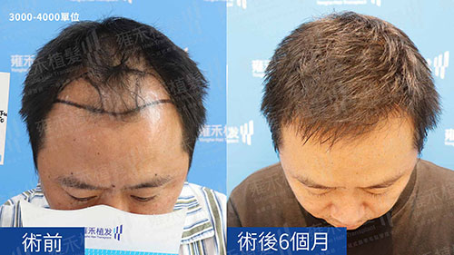 前後比